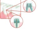filpost multidental