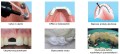 infibra multidental bioloren