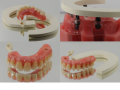 ŁUKI TRILOR® (TRILOR® ARCHES) - Bioloren